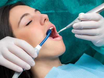 parodontologia pulizia denti